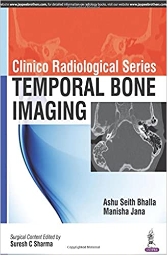 Clinico Radiological Series: Temporal Bone Imaging