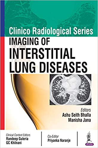 Imaging of Interstitial Lung Diseases (Clinico Radiological)