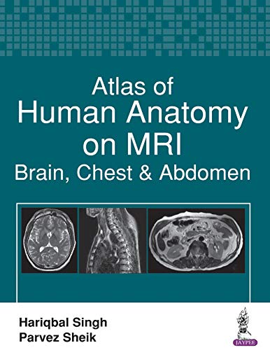 Atlas of Human Anatomy on MRI: Brain, Chest and Abdomen (Original PDF From Publisher)