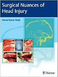 Surgical Nuances of Head Injury