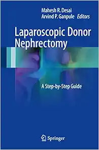 Laparoscopic Donor Nephrectomy: A Step-by-Step Guide