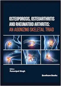 Osteoporosis, Osteoarthritis and Rheumatoid Arthritis: An Agonizing Skeletal Triad