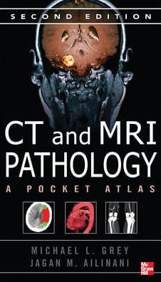 CT & MRI Pathology: A Pocket Atlas, Second Edition (ORIGINAL PDF from Publisher)