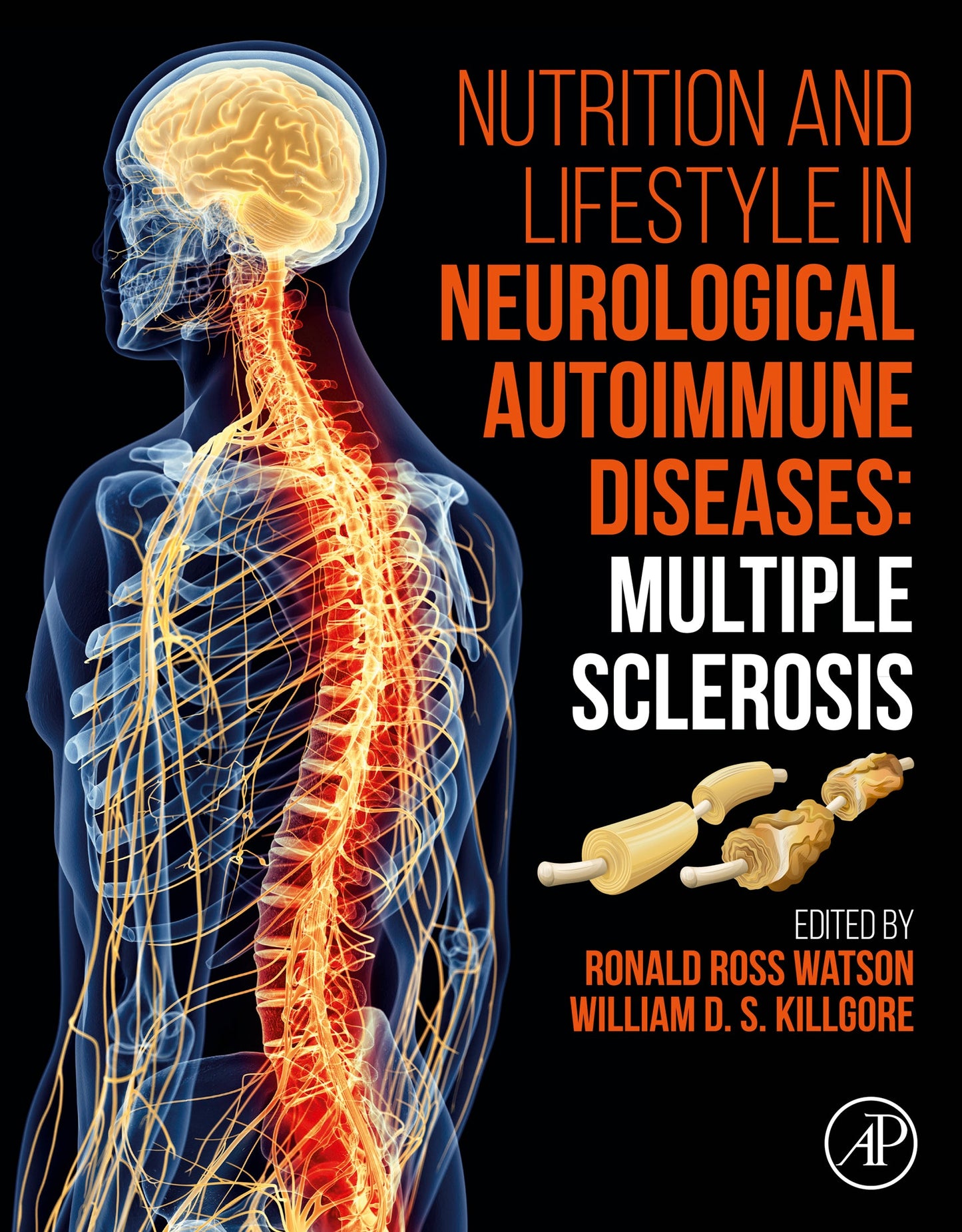 Nutrition and Lifestyle in Neurological Autoimmune Diseases: Multiple Sclerosis