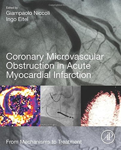 Coronary Microvascular Obstruction in Acute Myocardial Infarction: From Mechanisms to Treatment