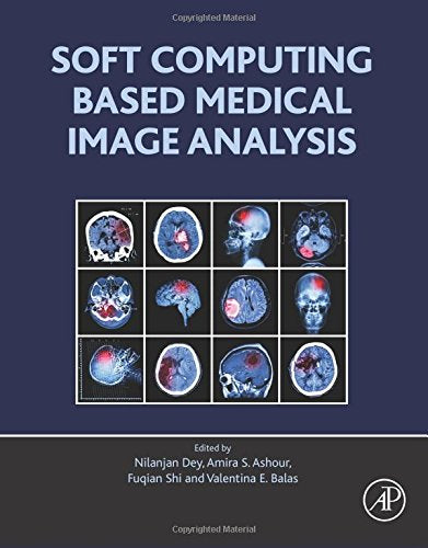 Soft Computing Based Medical Image Analysis (PDF)