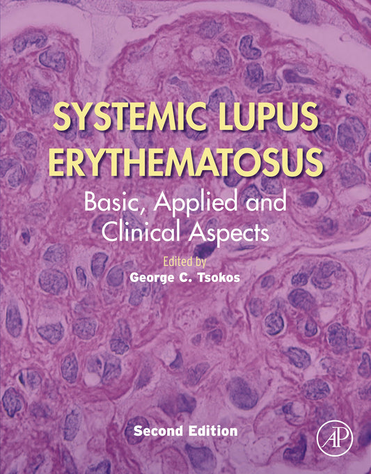 Systemic Lupus Erythematosus: Basic, Applied and Clinical Aspects, 2nd Edition