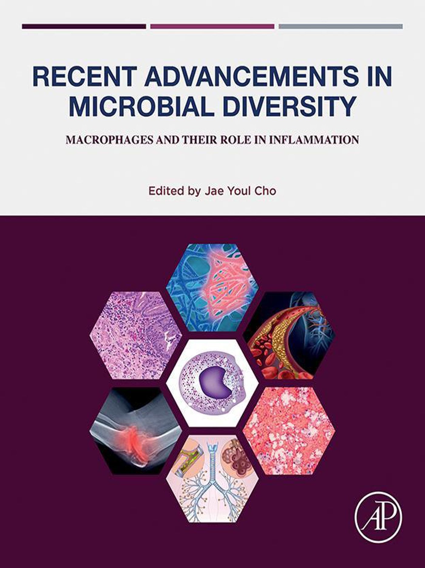 Recent Advancements in Microbial Diversity: Macrophages and their Role in Inflammation