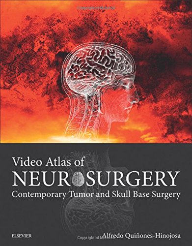 Video Atlas of Neurosurgery: Contemporary Tumor and Skull Base Surgery (ORIGINAL PDF from Publisher)