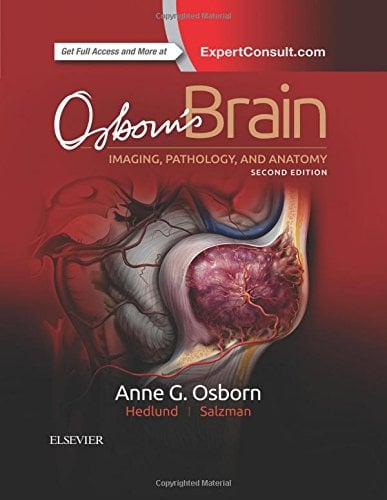 Osborn’s Brain, 2nd Edition (PDF)