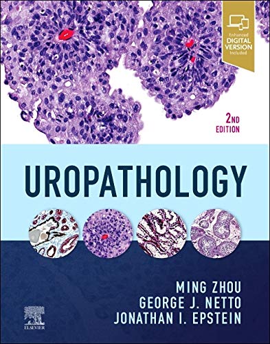 Uropathology, 2nd Edition