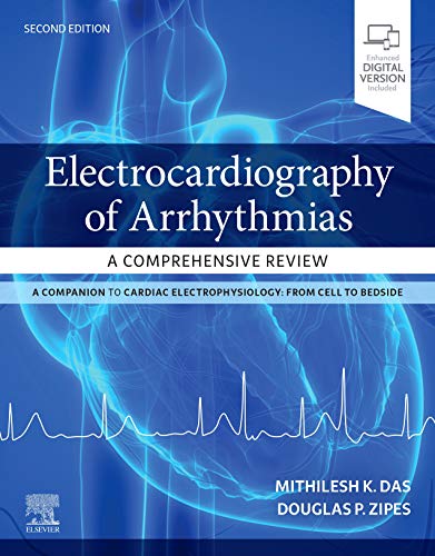 Electrocardiography of Arrhythmias: A Comprehensive Review: A Companion to Cardiac Electrophysiology, 2nd Edition