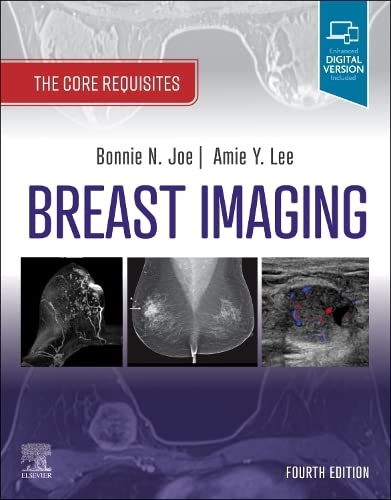 Breast Imaging: The Core Requisites, 4th edition