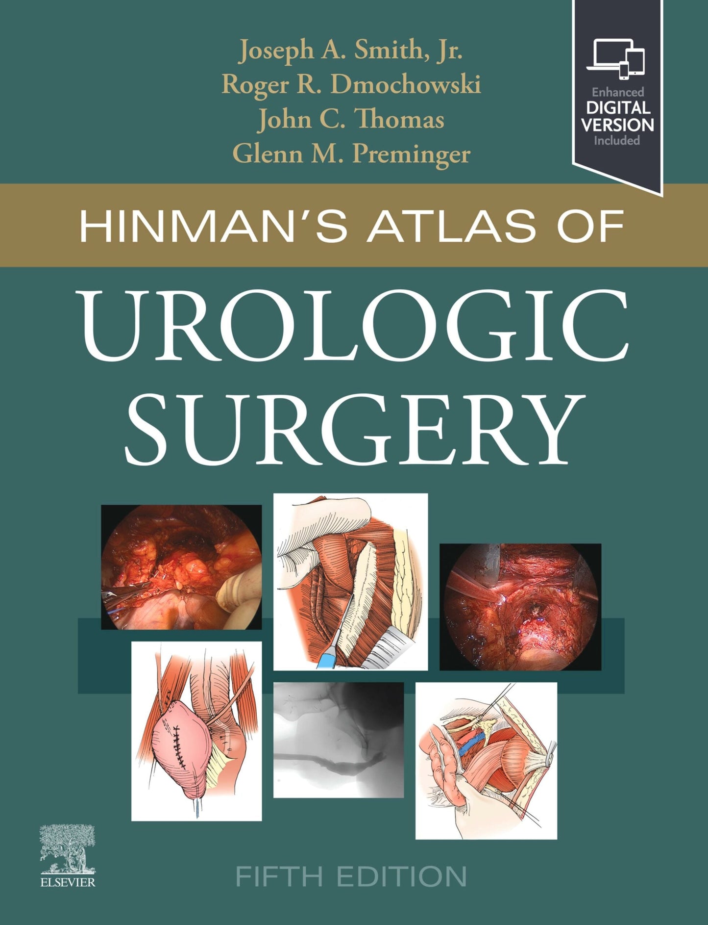 Hinman’s Atlas of Urologic Surgery, 5th Edition