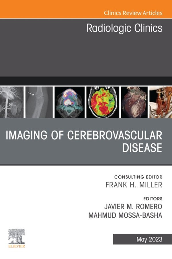 Imaging of Cerebrovascular Disease, An Issue of Radiologic Clinics of North America