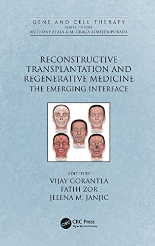 Reconstructive Transplantation and Regenerative Medicine: The Emerging Interface (Gene and Cell Therapy)