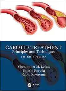 Carotid Treatment: Principles and Techniques, 3rd Edition