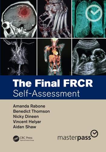 The Final FRCR: Self-Assessment (MasterPass)