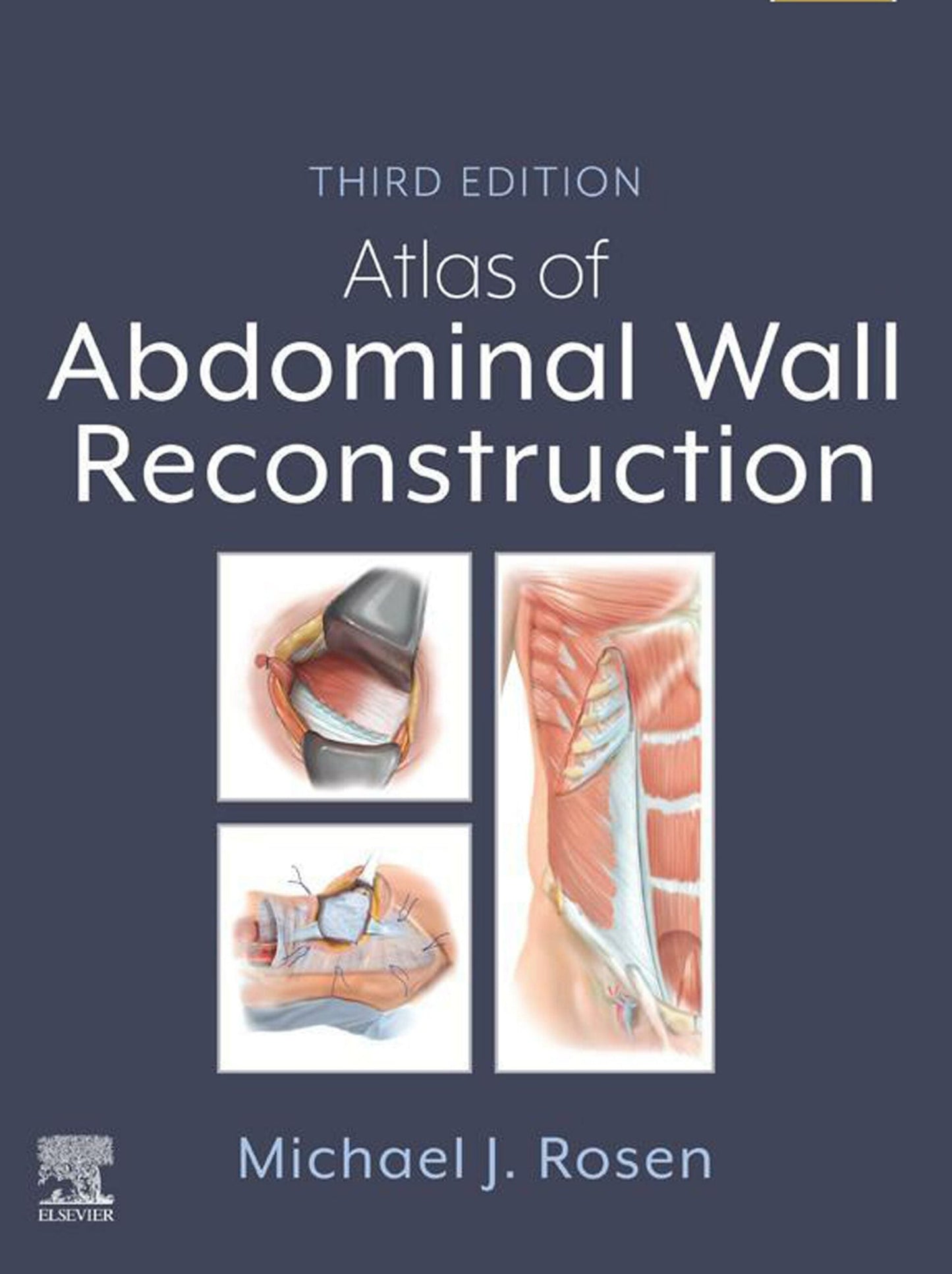 Atlas of Abdominal Wall Reconstruction, 3rd Edition