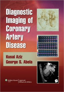 Diagnostic Imaging of Coronary Artery Disease (ORIGINAL PDF from Publisher)