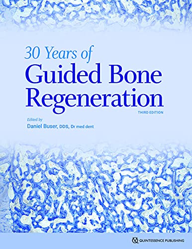 30 Years of Guided Bone Regeneration in Implant Dentistry, 3rd Edition