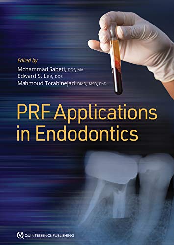 Platelet Rich Fibrin PRF Applications in Endodontics