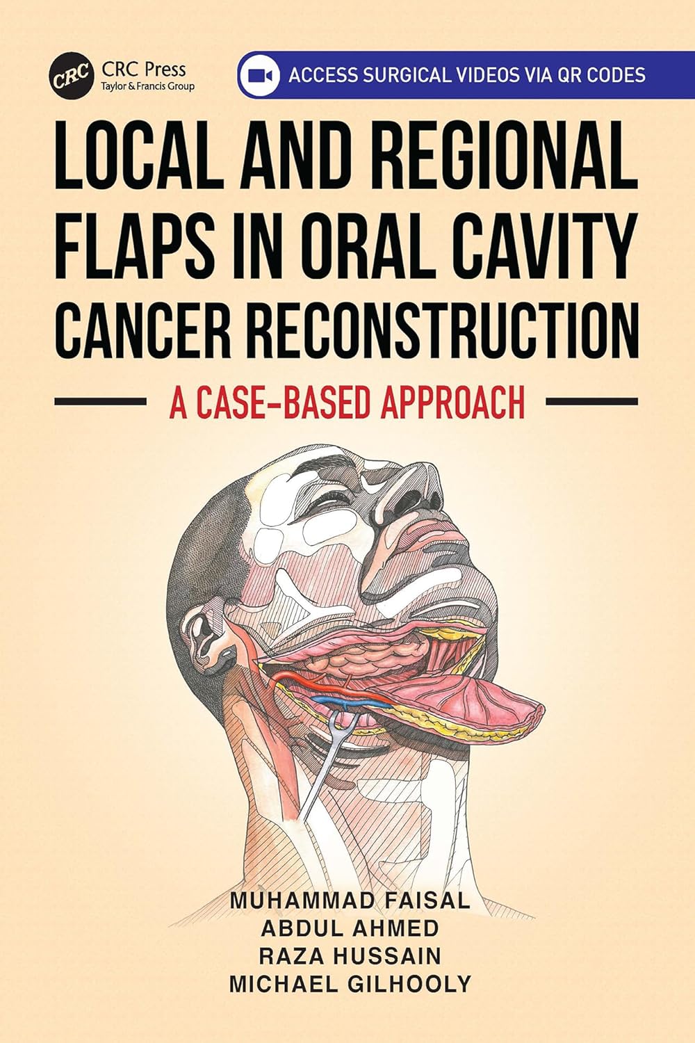 Local and Regional Flaps in Oral Cavity Cancer Reconstruction: A case-based approach