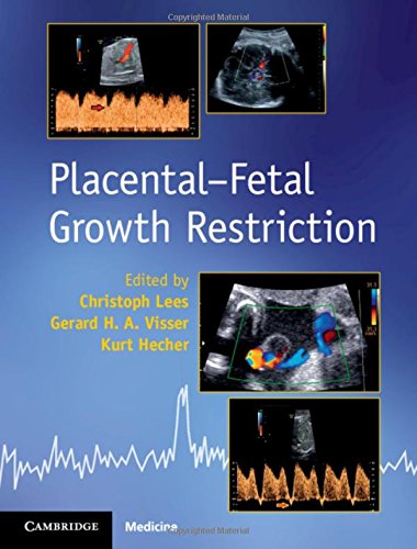 Placental-Fetal Growth Restriction (PDF)