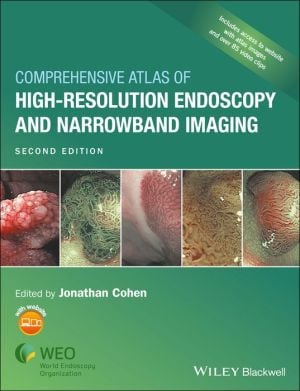 Comprehensive Atlas of High Resolution Endoscopy and Narrowband Imaging, 2nd Edition (PDF)