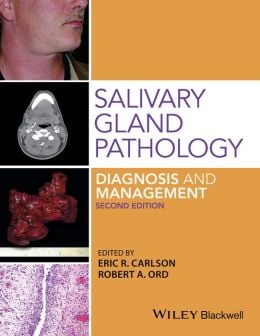 Salivary Gland Pathology: Diagnosis and Management, 2nd Edition