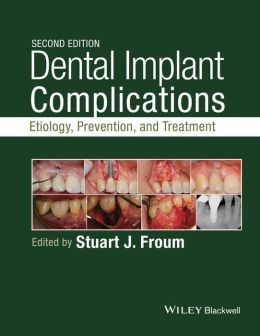 Dental Implant Complications: Etiology, Prevention, and Treatment, 2nd Edition