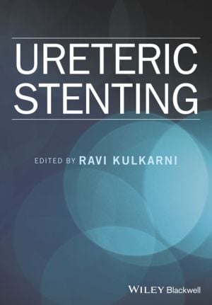 Ureteric Stenting (PDF)