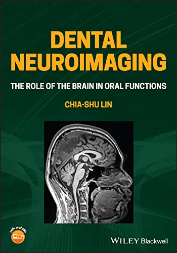 Dental Neuroimaging: The Role of the Brain in Oral Functions