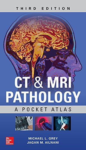 CT & MRI Pathology: A Pocket Atlas, Third Edition (ORIGINAL PDF from Publisher)