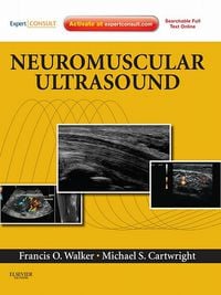 Neuromuscular Ultrasound: Expert Consult – Online and Print, 1e