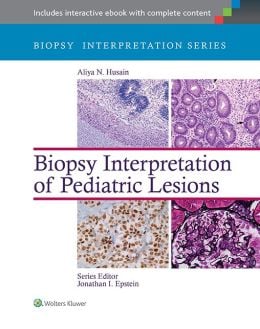 Biopsy Interpretation: Pediatric Lesions (ORIGINAL PDF from Publisher)
