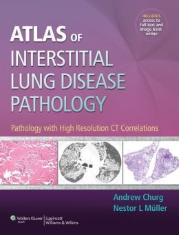 Atlas of Interstitial Lung Disease Pathology: Pathology with High Resolution CT Correlations (ORIGINAL PDF from Publisher)