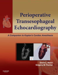 Perioperative Transesophageal Echocardiography: A Companion to Kaplan’s Cardiac Anesthesia