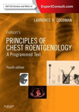 Felson’s Principles of Chest Roentgenology, A Programmed Text, 4th Edition (ORIGINAL PDF from Publisher)