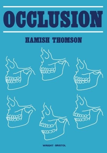Occlusion
