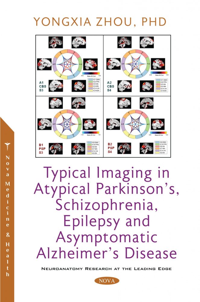Typical Imaging in Atypical Parkinson’s, Schizophrenia, Epilepsy and Asymptomatic Alzheimer’s Disease (Original PDF From Publisher)
