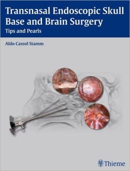 Transnasal Endoscopic Skull Base and Brain Surgery: Tips and Pearls (ORIGINAL PDF from Publisher)