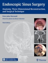 Endoscopic Sinus Surgery, 3rd Edition