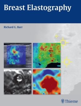 Breast Elastography (ORIGINAL PDF from Publisher)