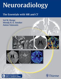 Neuroradiology: The Essentials with MR and CT