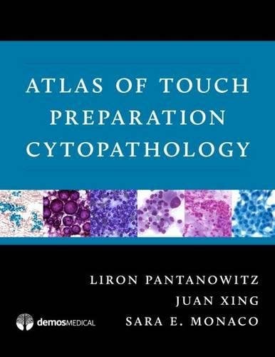 Atlas of Touch Preparation Cytopathology (PDF)