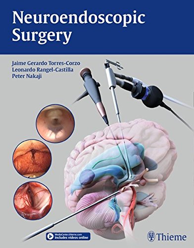 Neuroendoscopic Surgery (PDF)