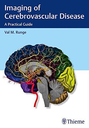 Imaging of Cerebrovascular Disease: A Practical Guide (ORIGINAL PDF from Publisher)