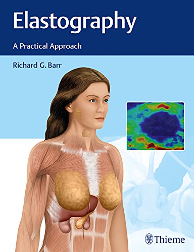Elastography: A Practical Approach (PDF)