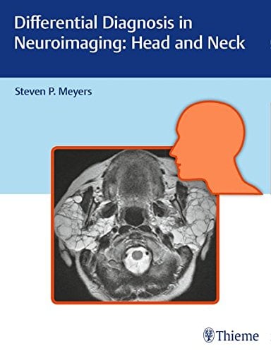 Differential Diagnosis in Neuroimaging: Head and Neck (PDF)